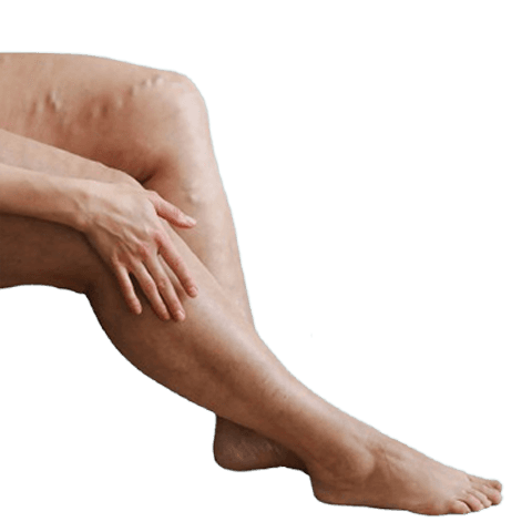 Uterine Fibroid Embolization Patient