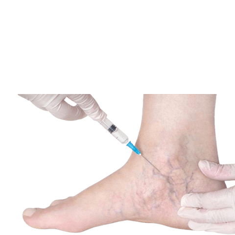 Uterine Fibroid Embolization Patient