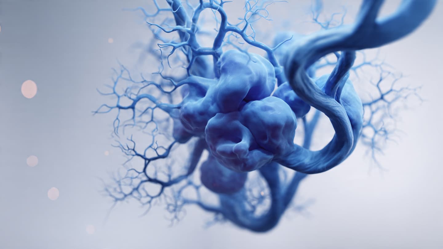 Vascular malformations